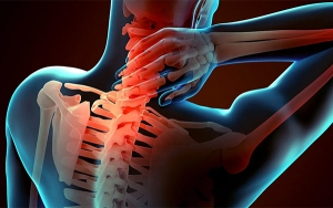 ORIZZONTI POSTURALI - La colonna vertebrale (parte 3): la cervicalgia