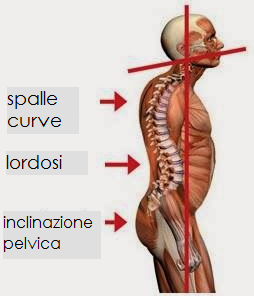 ORIZZONTI POSTURALI - La colonna vertebrale (parte 3): la cervicalgia - FIF