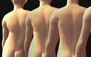 ORIZZONTI POSTURALI - Scoliosi e fascia